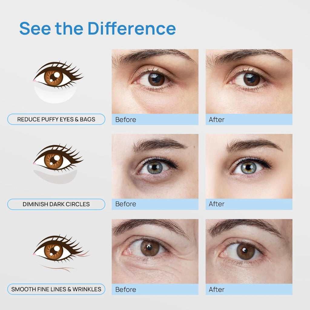 Bleuvél Under Eye Masks - 14 Pairs