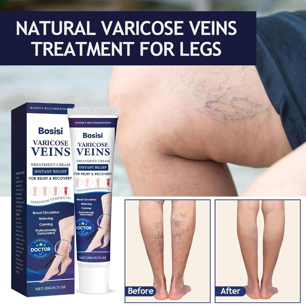 Bosisi Varicose Veins Treatment, 0.71 oz