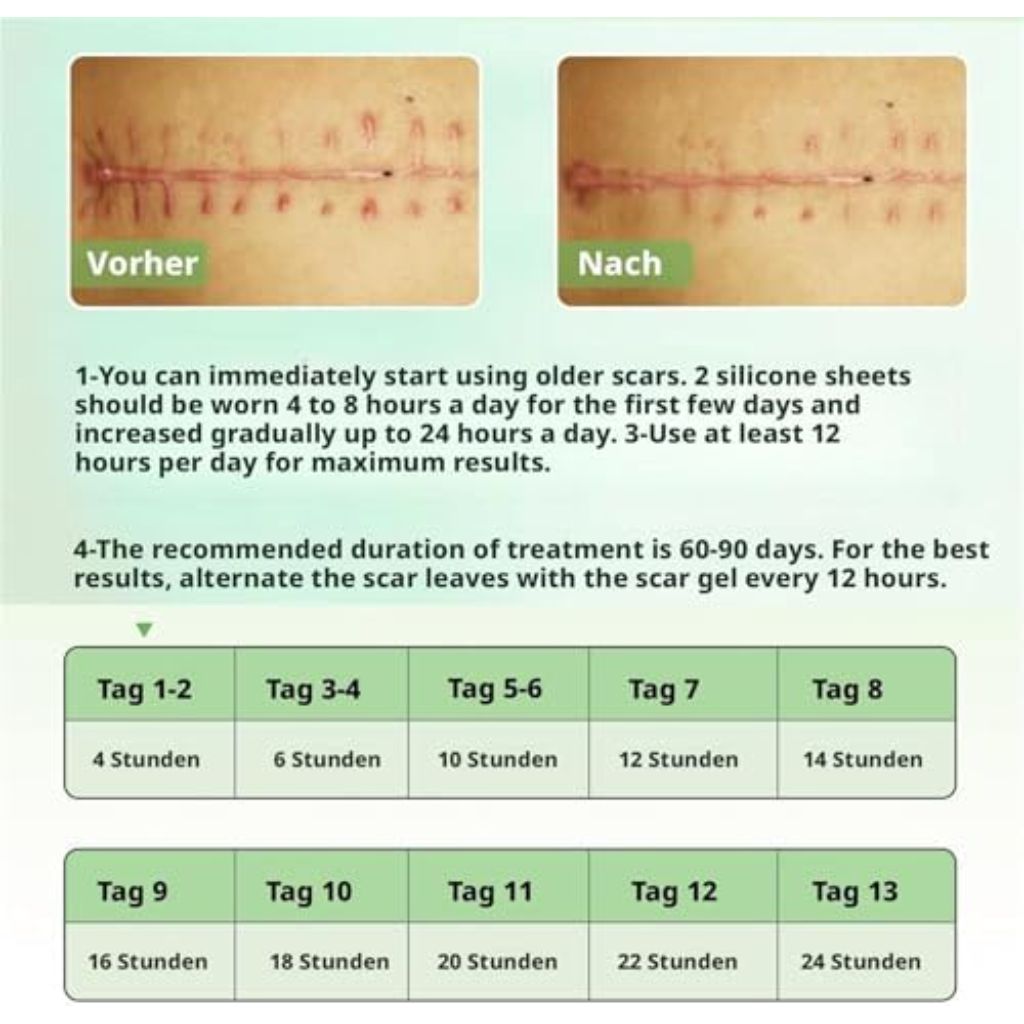 Silicone Scar Tape, (1.6X116 inches), Silicone Scar Tape for Scar Removal Treatment, Suitable for Caesarean Section, Scars, Burns, Acne, Surgical Scars