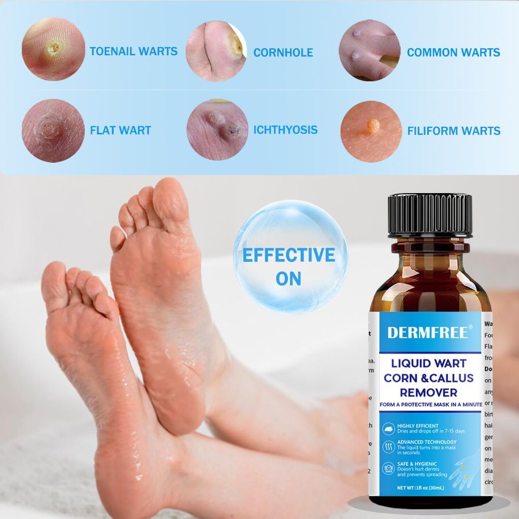 Liquid Wart, Corn, & Callus Remover with Salicylic Acid - 1 fl. oz.