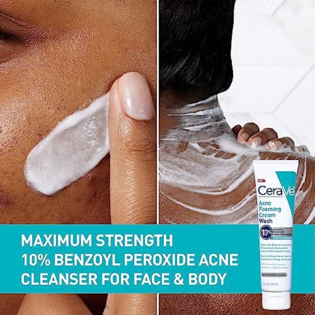 CeraVe Acne Foaming Cream Wash with 10% BPO - 5 fl. oz.