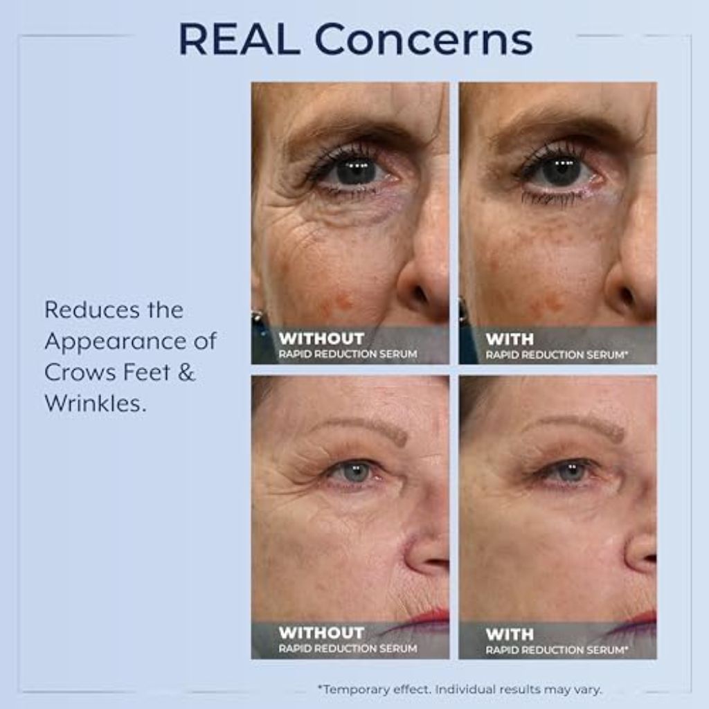 Plexaderm Rapid Reduction Eye Serum Advanced Formula Reduces Under-Eye Bags & Wrinkles - 0.33 fl. oz.