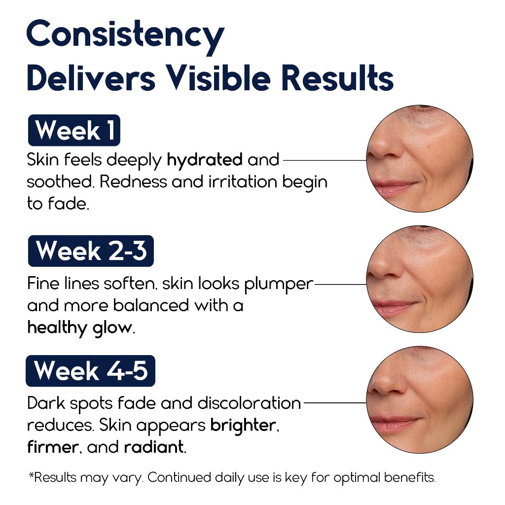 Hyaluron B5 Pure Hyaluronic Acid Serum for Face – 2.5% Hyaluronic Acid + 3% B5 - 1 fl. oz.