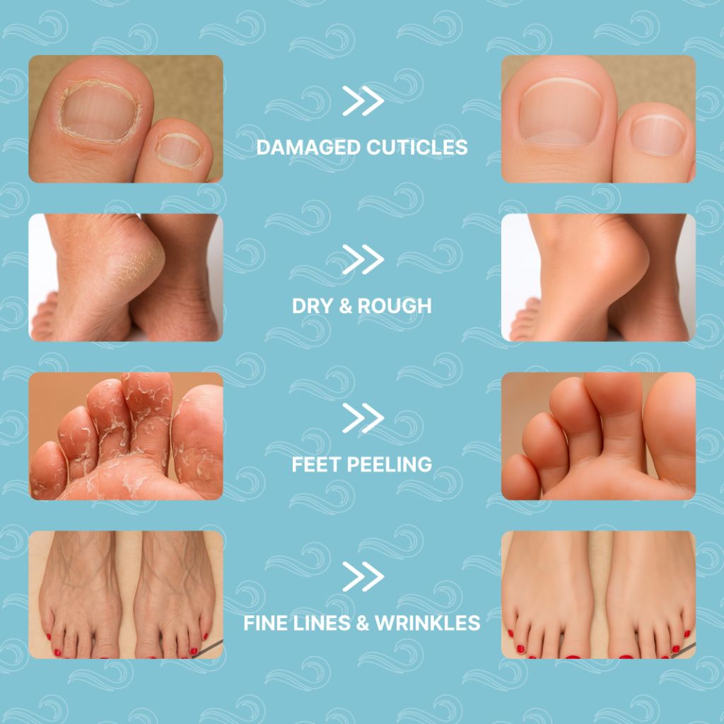 Bayside Foot Mask Moisturizing Socks for Dry Cracked Feet - 6 Pairs
