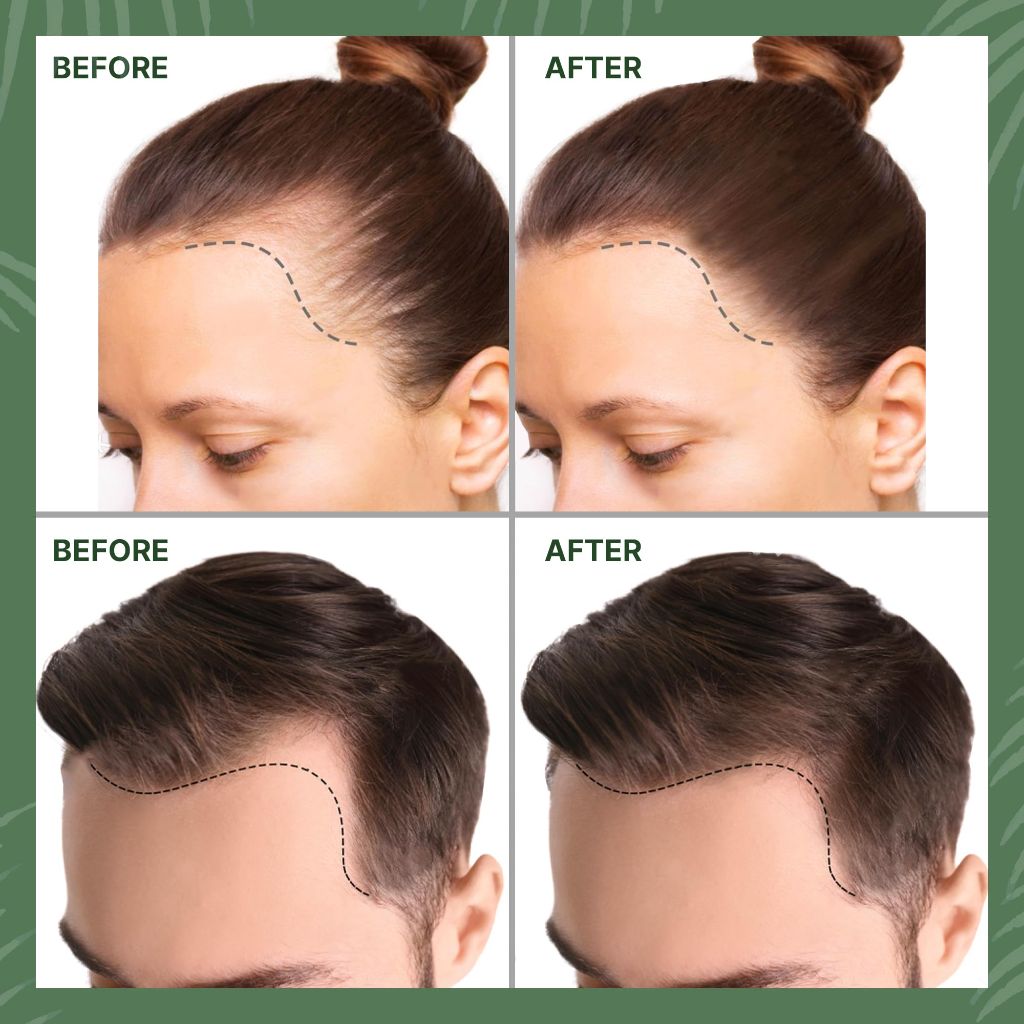 Felero 100% Pure, Organic, Unrefined Batana Oil for Hair Growth - 4.05oz