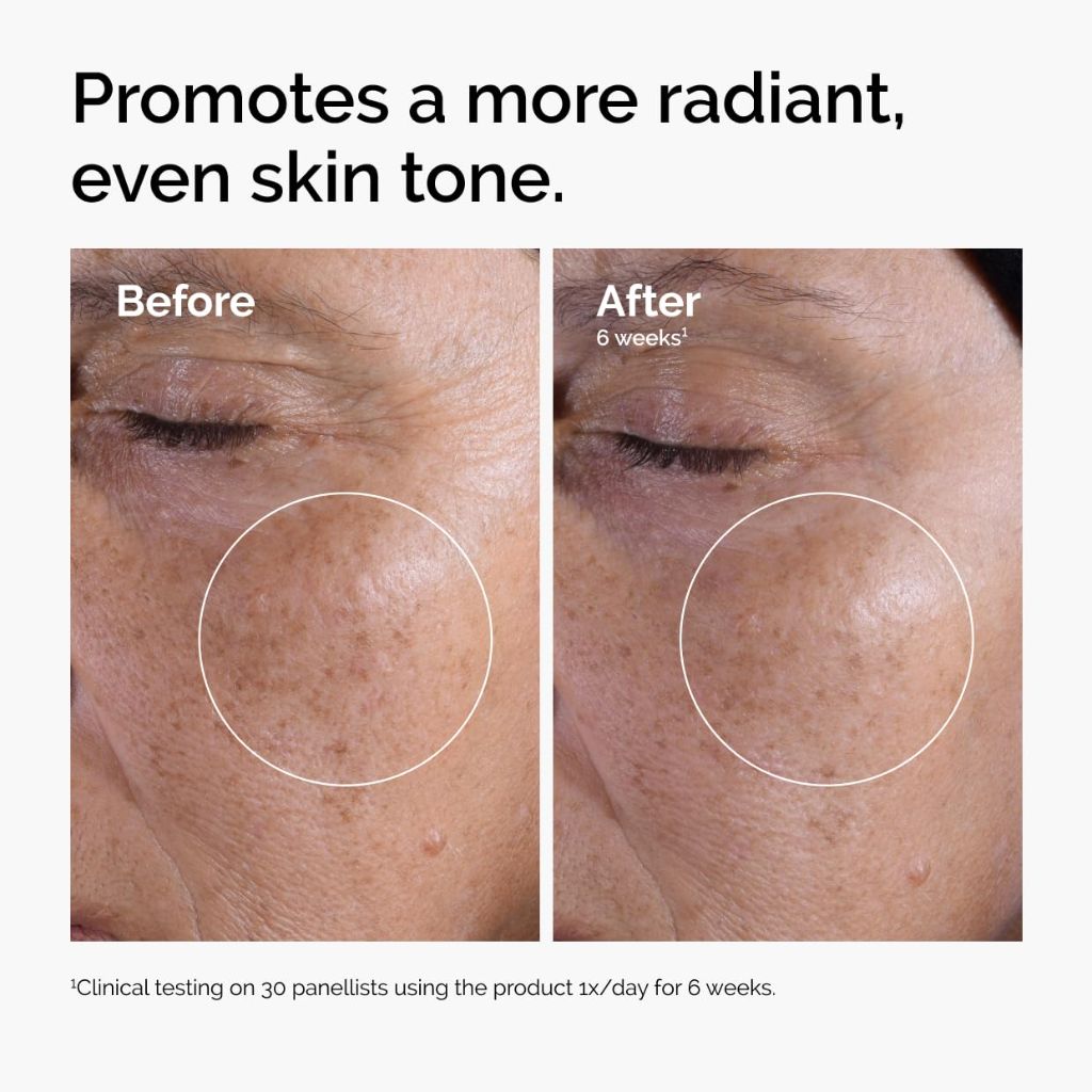 The Ordinary Glycolic Acid 7% Exfoliating Toner - 8.1 fl. oz.