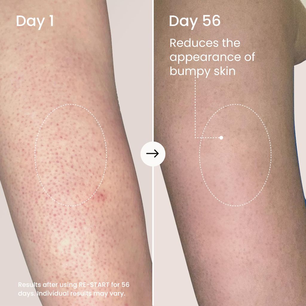 MAËLYS Re-Start Resurfacing Body Serum - 3.5 fl. oz.