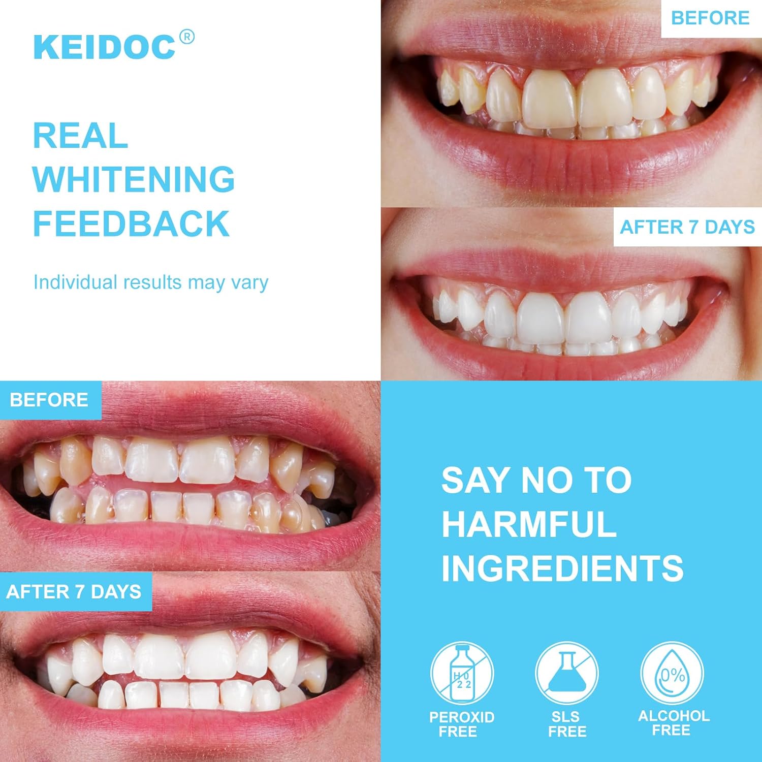 Keidoc Teeth Whitening Strips, Enamel-Safe Natural White Strips, Non-Sensitive, Mint, 28 Strips (14 Treatments)