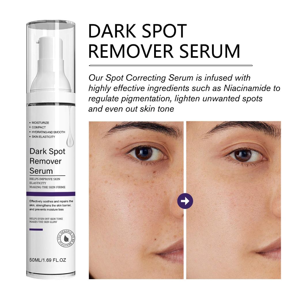 Dark Spot Removal Serum, for Men and Women 1.69 fl.oz