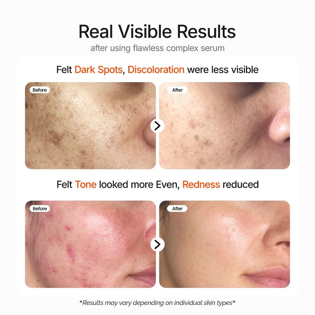 The SkinPixels 10% Niacinamide Brightening & Glow Face Serum - 30ml