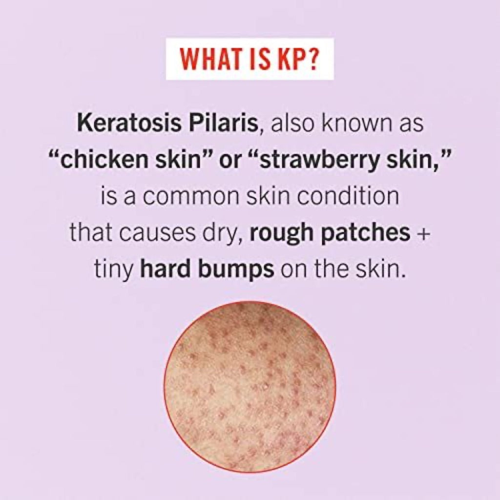 First Aid Beauty KP Bump Eraser Body Scrub with 10% AHA 283.5g