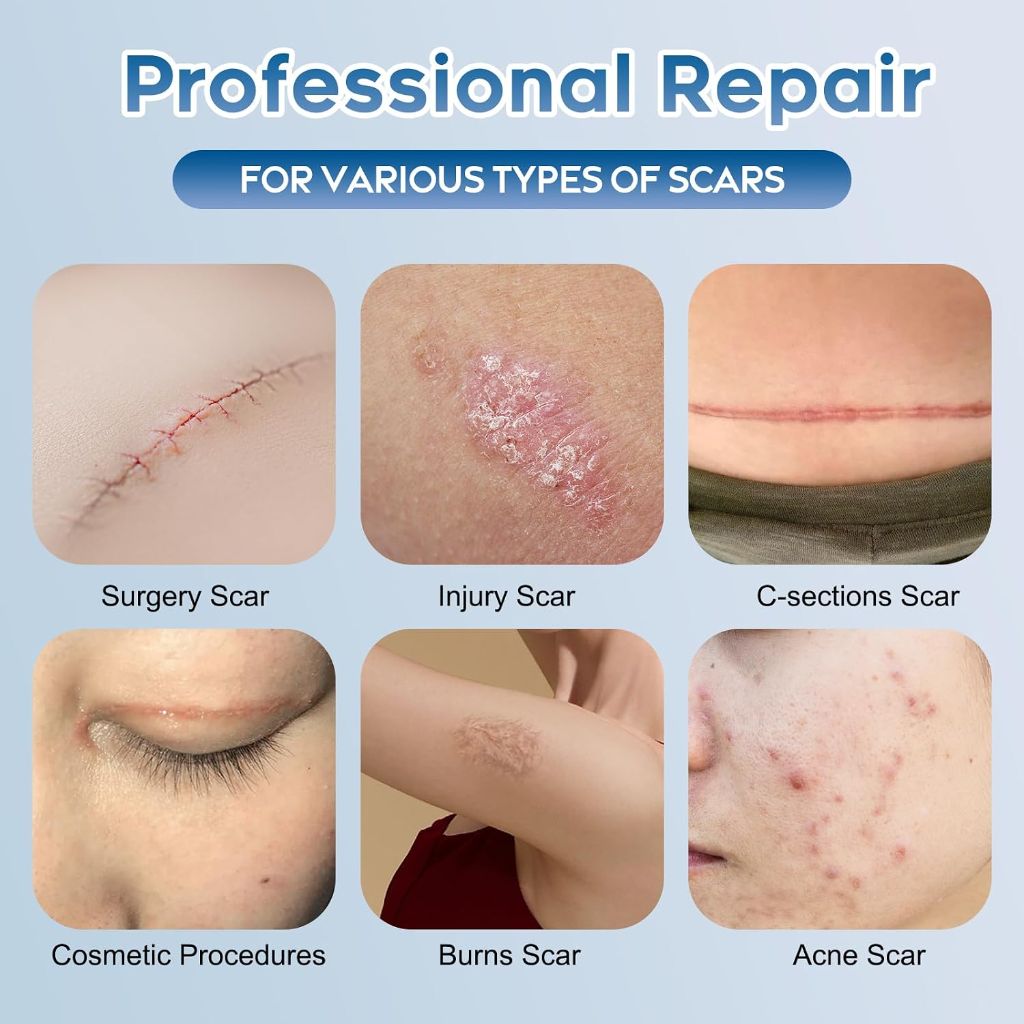Glowor - Advanced Silicone Scar Gel for Face & Body – 3.53 oz (100g)