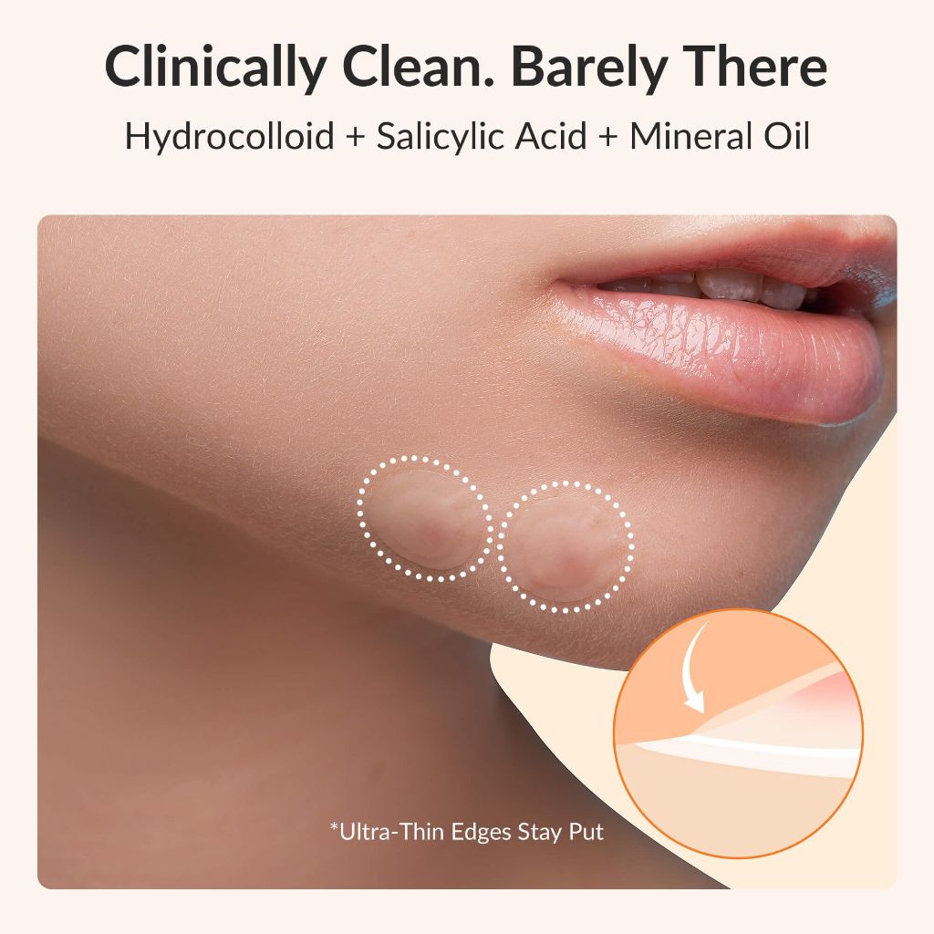 RPE Life Invisible Pimple Patches – 144 Patches