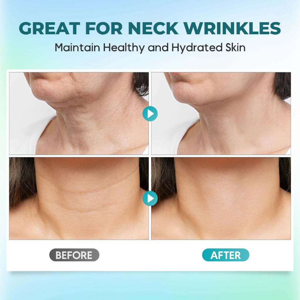 Neck Wrinkle Patches, 5PCS, Neck Tape for Neck Firming and Tightening