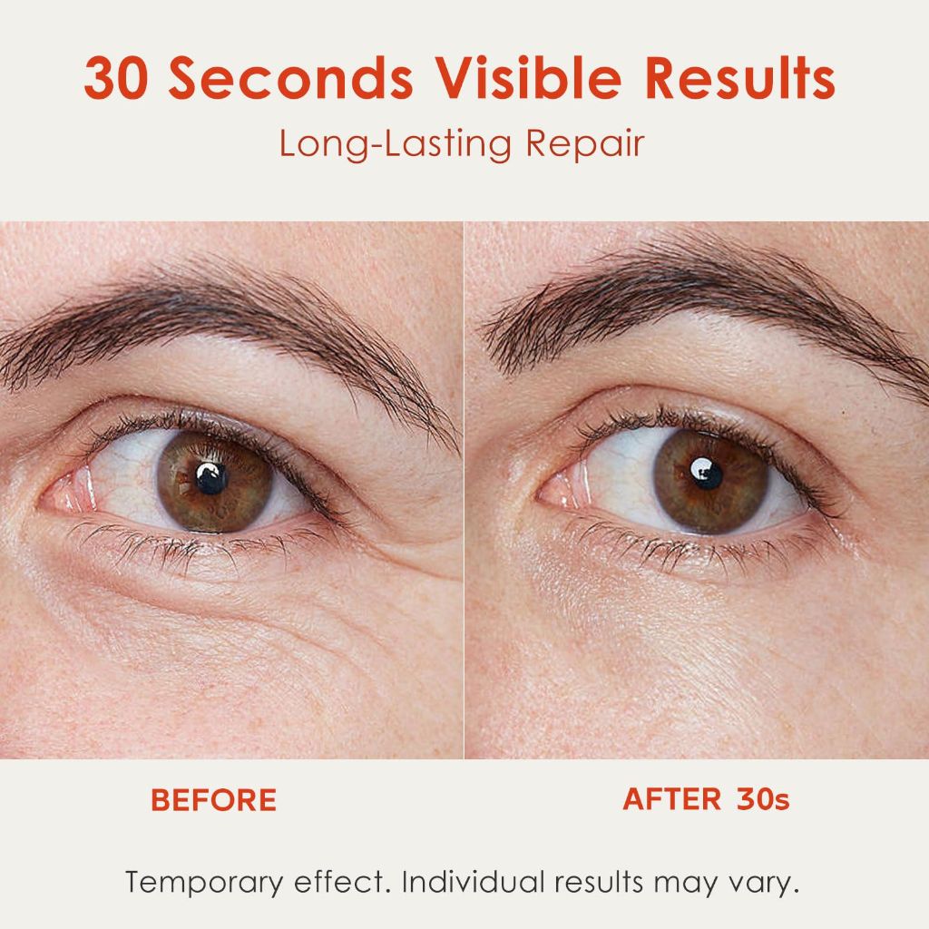 Muxmrx 30S Instant Eye Lift Cream | Temporary Eye Tightener | 0.71 Fl Oz