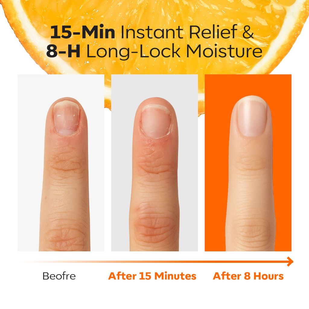 Modelones Cuticle Oil Pen Orange Nail Oil - 10ml 0.34Fl Oz