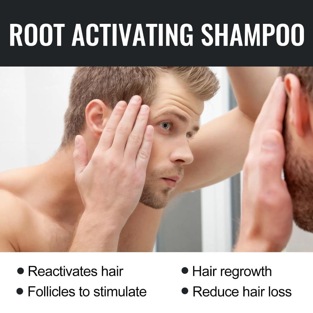 Yuucangh- Root Activator Shampoo, Hair Regrowth, Unisex (350 ML)