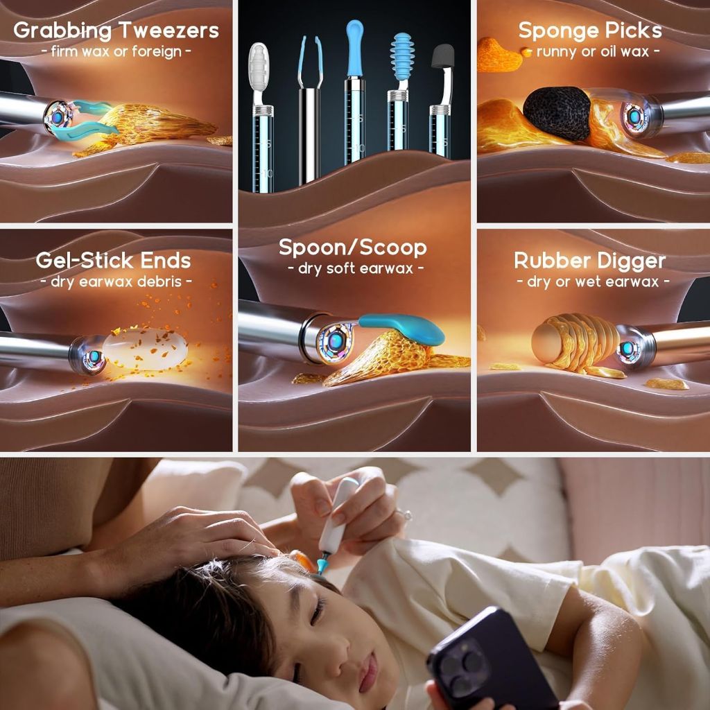 Bebird Home 30S Ear Wax Removal, Smart Ear Care System Cleaner Kit