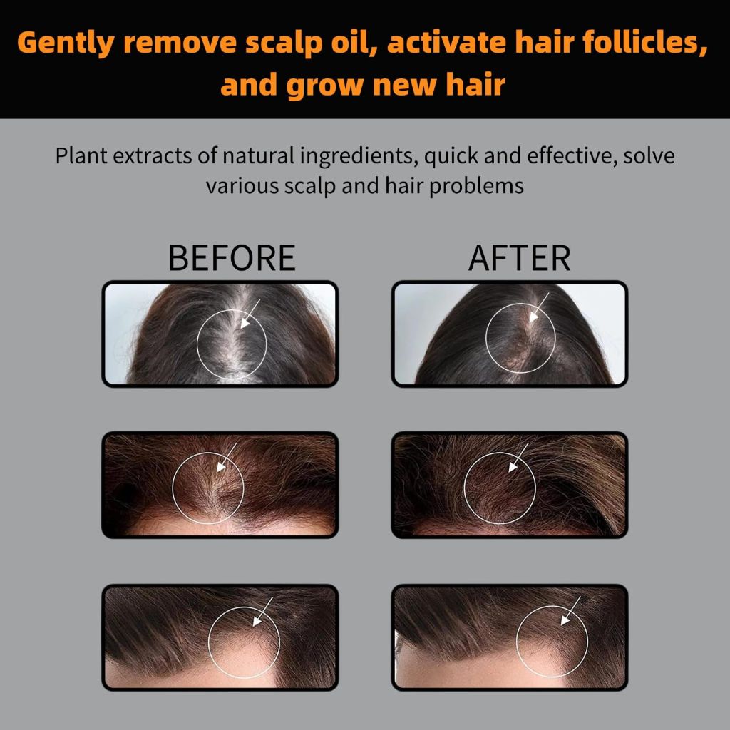 Root Activator Shampoo for Hair Loss - 3 fl oz