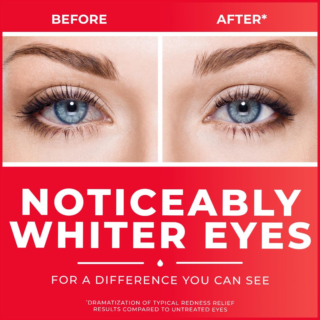 Clear Eyes Redness Eye Relief Eye Drops, 0.5 fl oz (Pack of 1)
