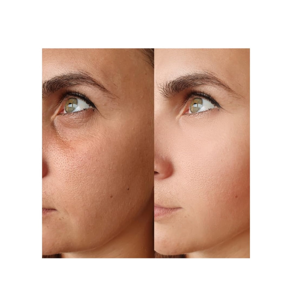 ZAIN1 Snail Mucin Regenerating Face Serum w/Hyaluronic Acid and Damascus Rose for Anti-Aging, Hydration, Radiance, 1 fl. oz.