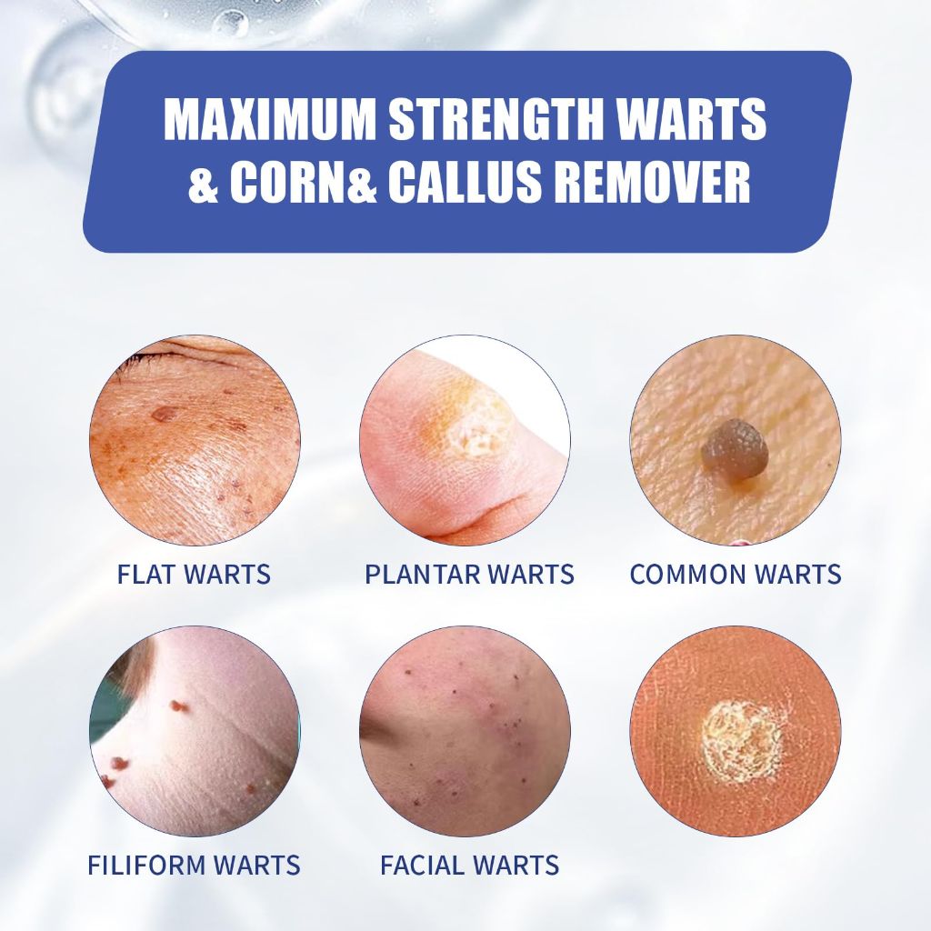 Likluc Fast-Acting Wart Remover Gel