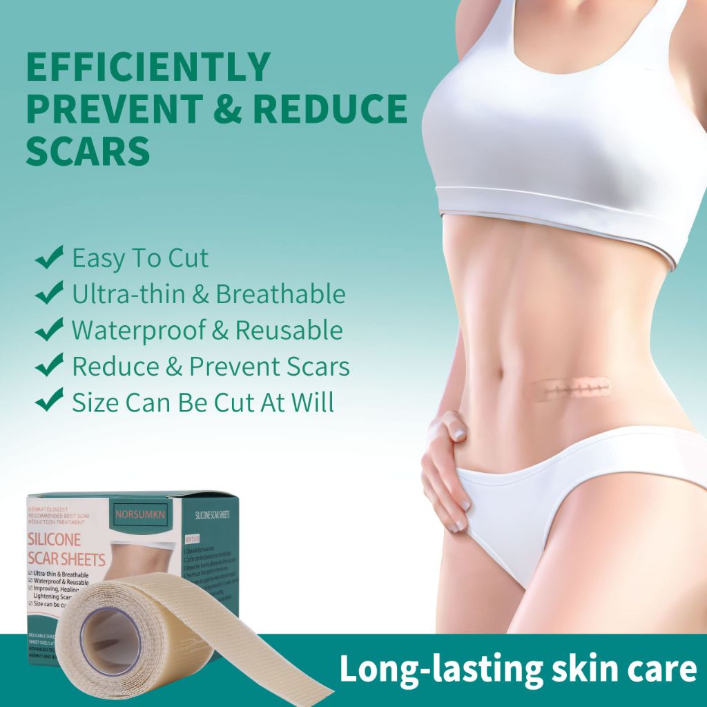 Norsumkn Silicone Scar Tape 1.6"X 60"