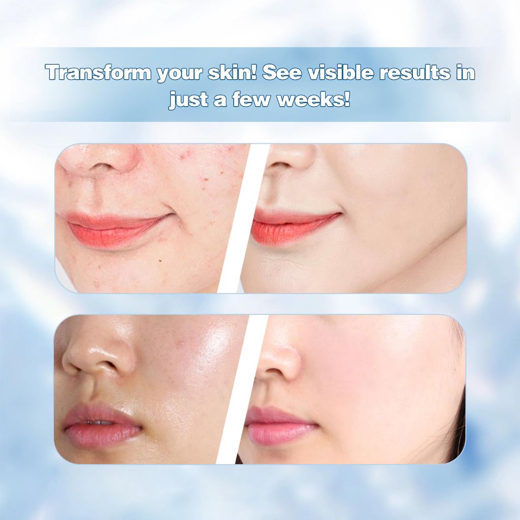 Noageryas Milk Skin Corrector Cream with Hyaluronic Acid, Vitamin C, Niacinamide & 45% Multi-Action Concentrate - 1.86oz
