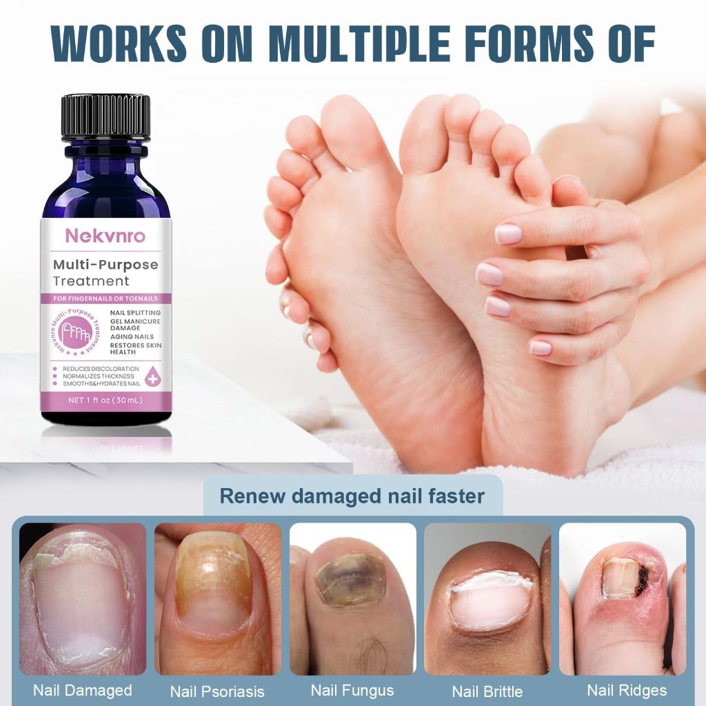 Nekvnro Nail Fungus Treatment, Effective Toenail Fungus Solution for Fast Results - 1 fl. oz.