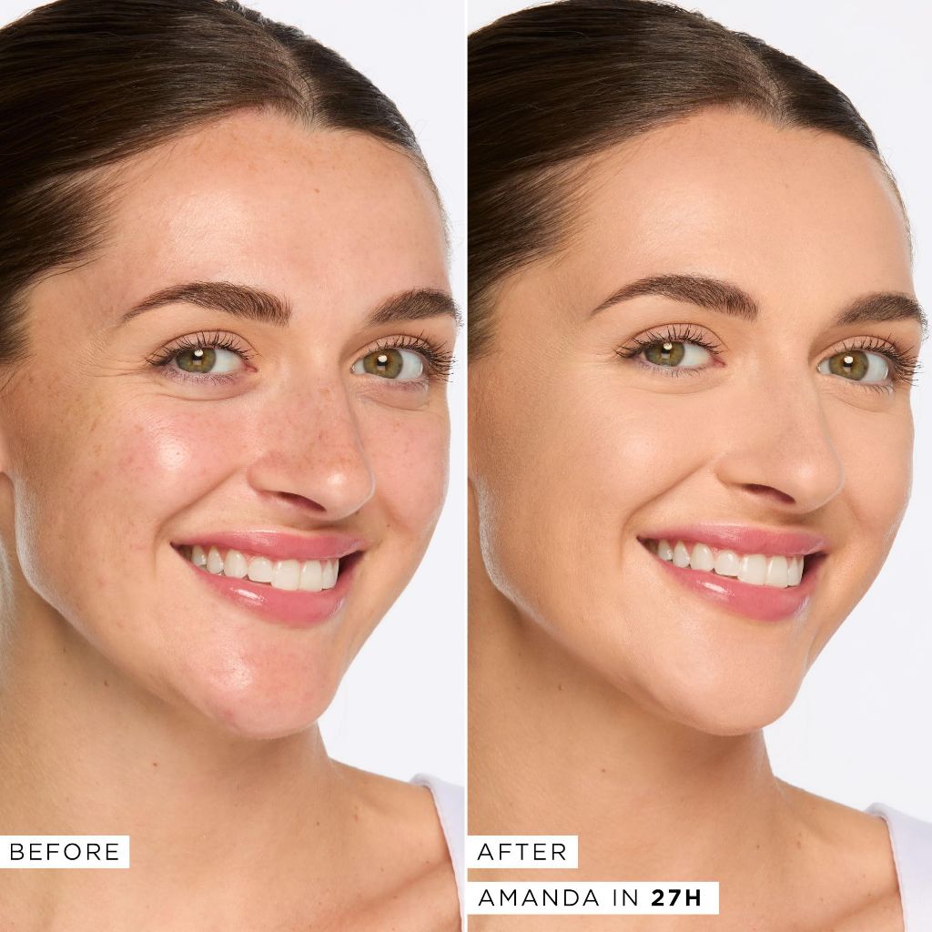 tarte Shape Tape Concealer, Full-Coverage Soft Matte Finish - 27H Light-Medium Honey, 0.33 fl. oz.
