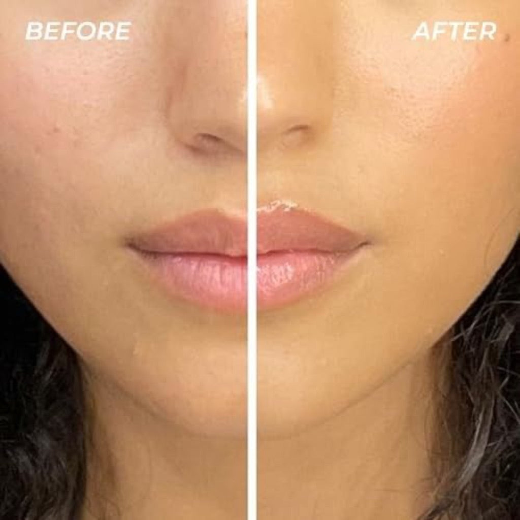 Mega Balm All-Over Ointment