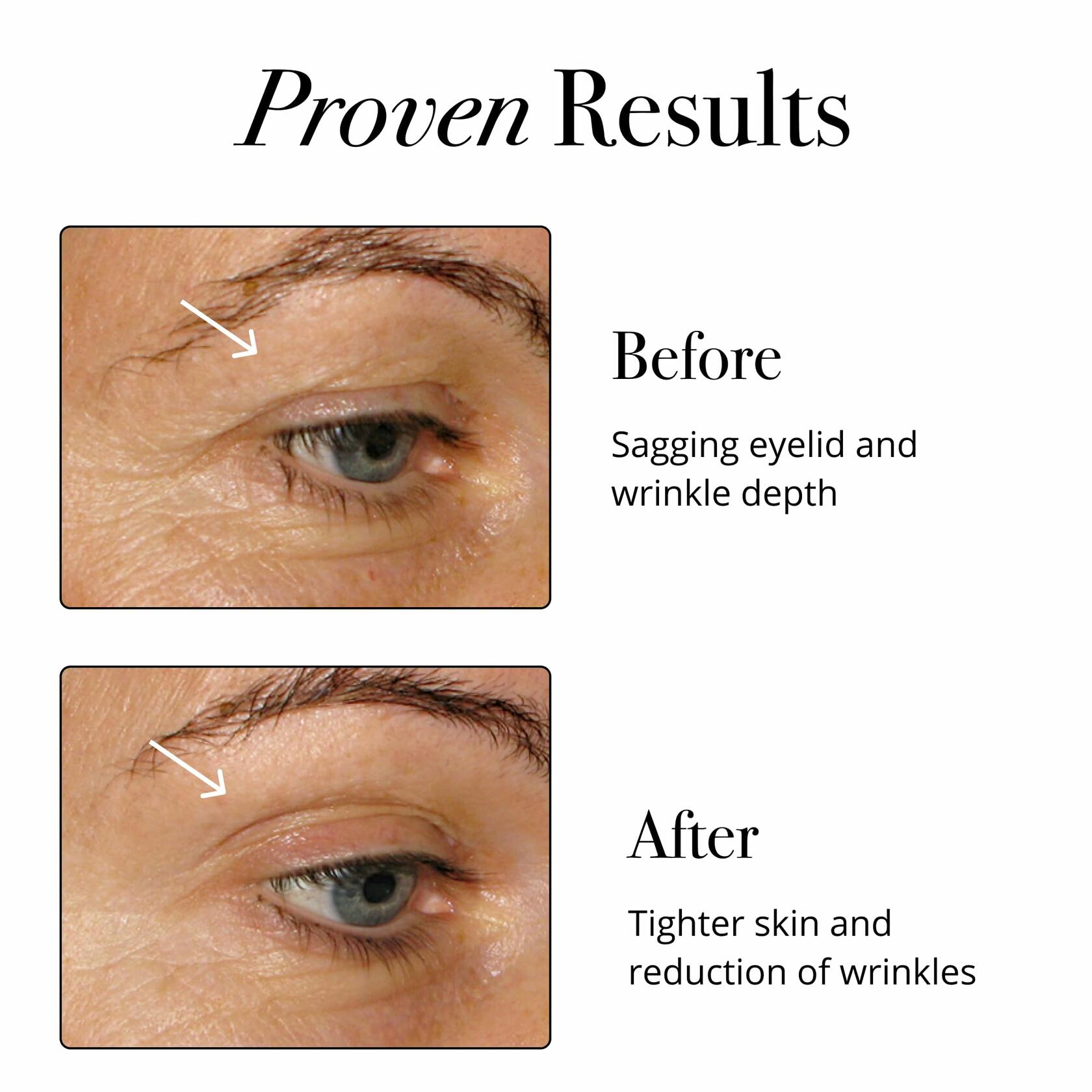 Glotrition Super Beauty Elixir Collagen Peptides Powder, 30ct, Sweet-Tart Berry