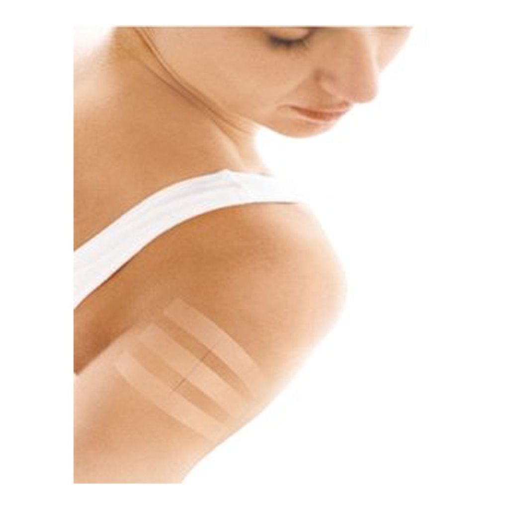 Nexcare™ Steri-Strip™ Wound Closure