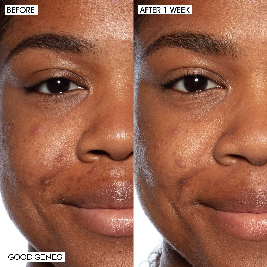 Sunday Riley Instant Gratification Exfoliate + Brighten Set