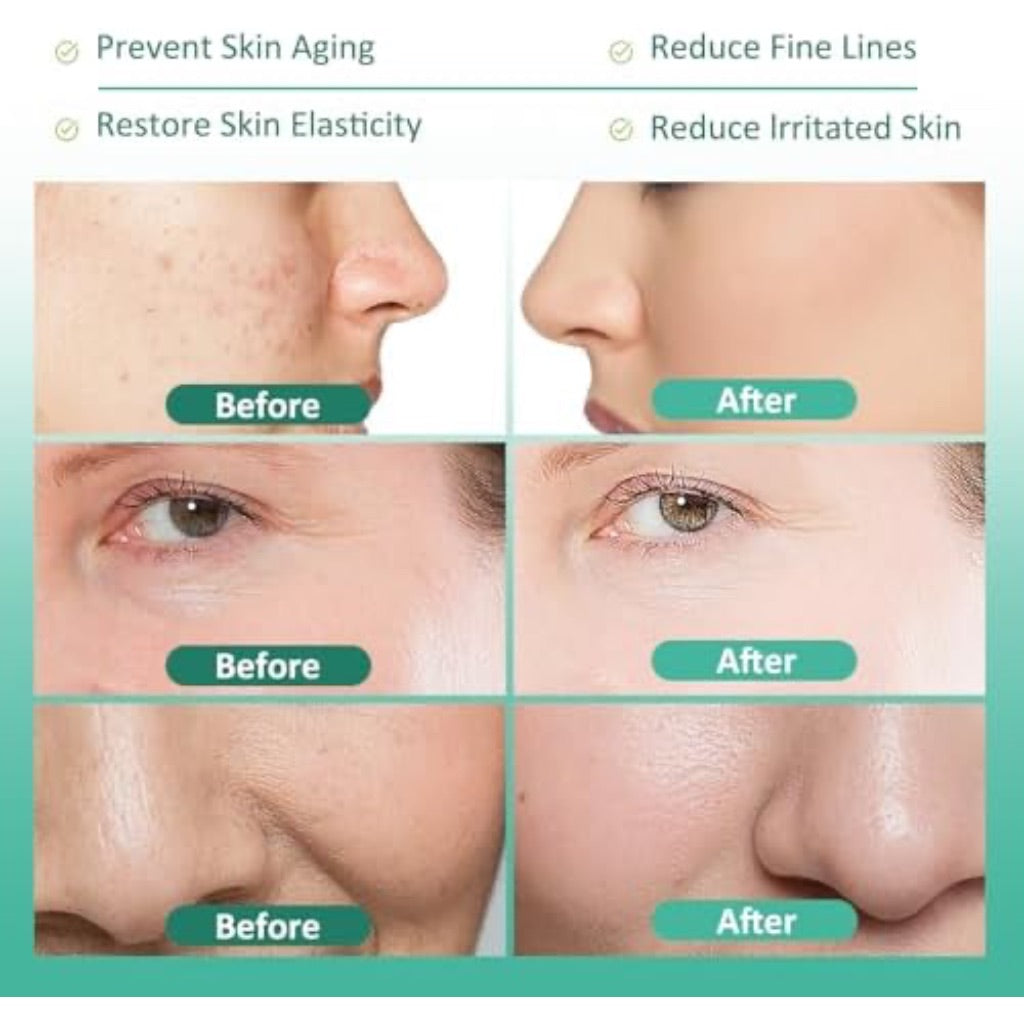 Salmon PDRN Serum, Concentrate 10,000ppm PDRN, Salmon DNA for Skin Glow, Skin Barrier Restoration & Plumping, Smoothing Fine Lines & Firming, Hydrating & Calming, Skincare (30ml, 1.0 fl.oz.)