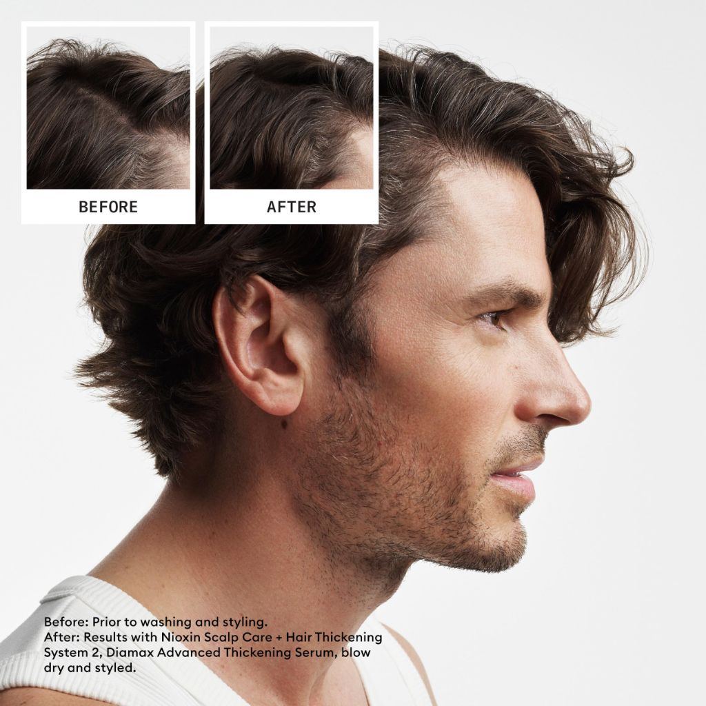 Nioxin Scalp + Hair Thickening System 2 Shampoo | 33.8 Fl oz.