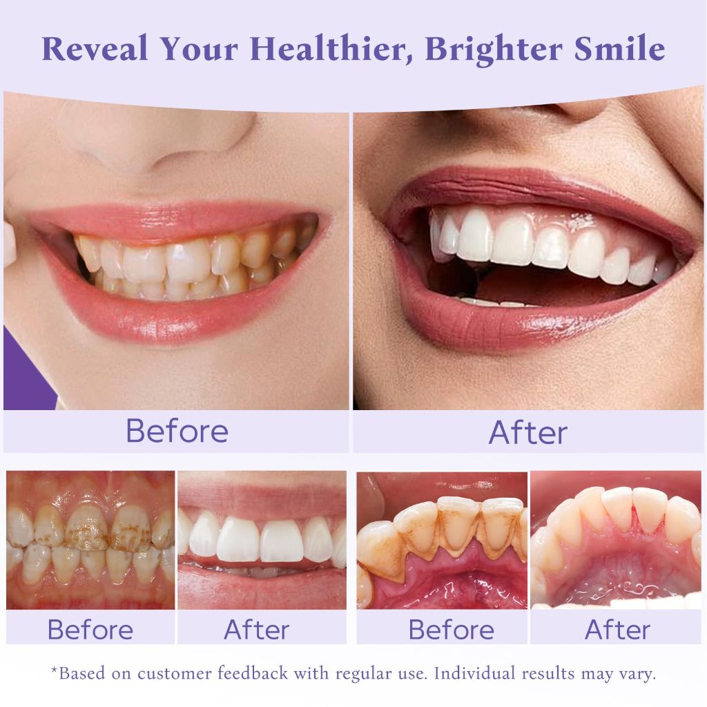 Teeth Whitening Powder, Enamel Repair & Long-Lasting Natural White-30g