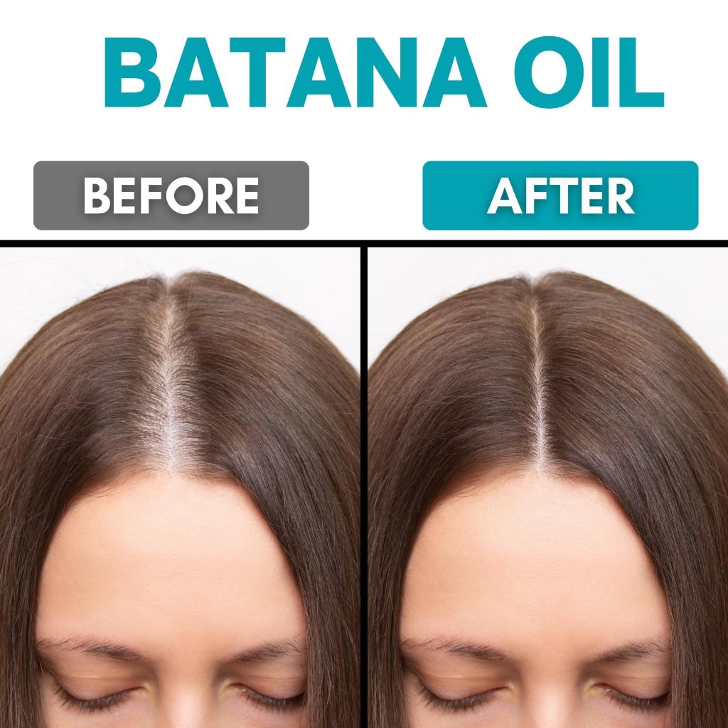 Raw Batana Oil for Hair Growth -,100% Pure Batana Hair Mask, - 4.23 fl oz