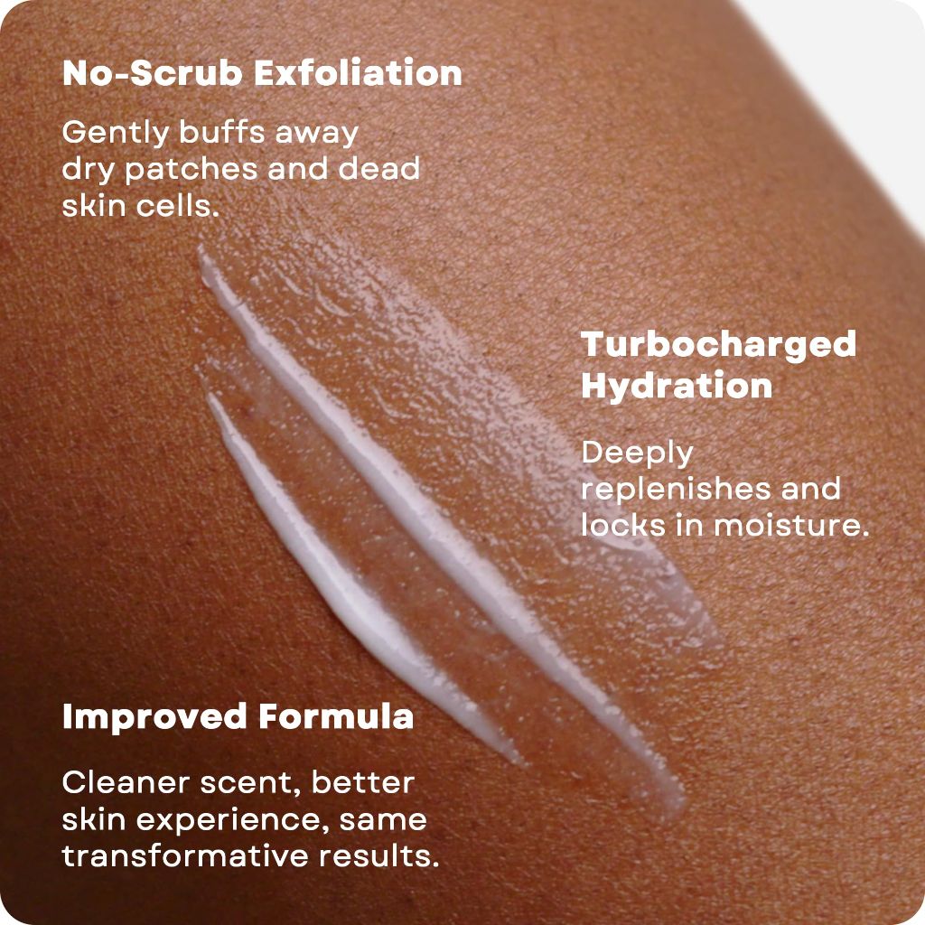 AmLactin Daily Nourish Therapeutic Body Lotion for Dry Skin -  14.1 oz (Packaging May Vary)