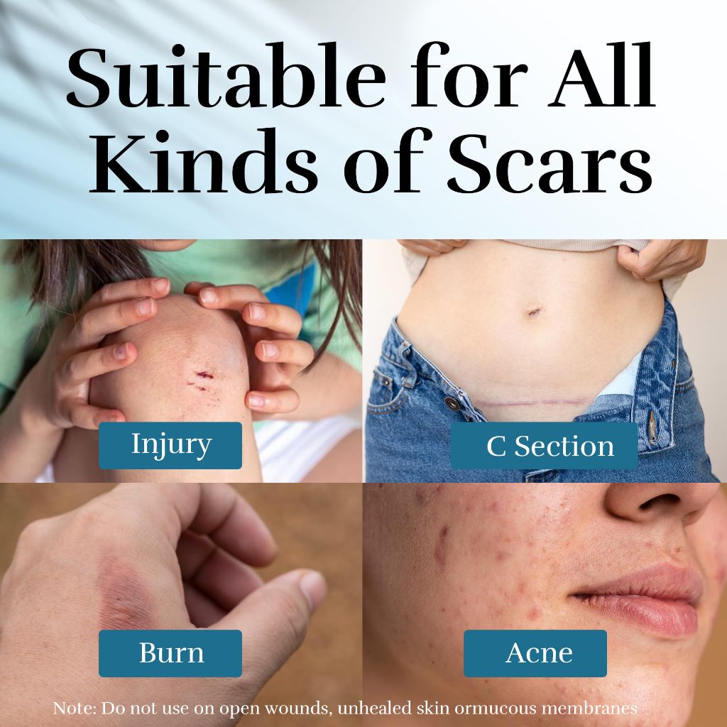 Silicone Scar Cream, 1.76 Oz (50g)