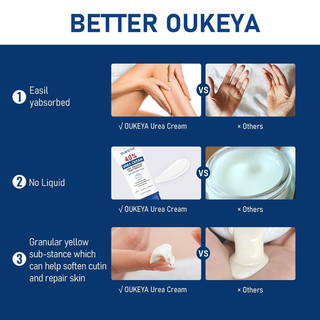OUKEYA Urea Cream 40 Percent Tube 3 Oz, Foot & Hand Cream for Dry Cracked,  Maximum Strength