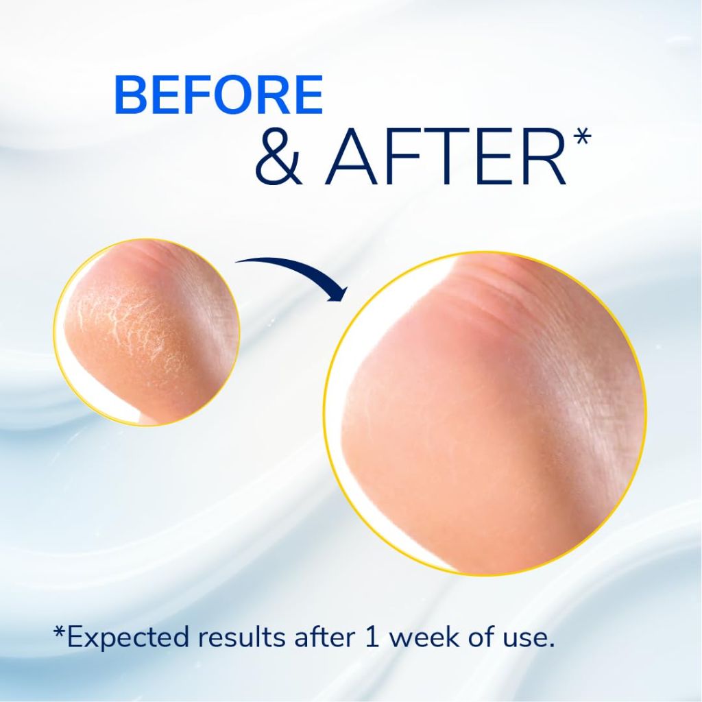Dr. Scholl's Severe Cracked Heel Repair Restoring Balm, 2.5oz