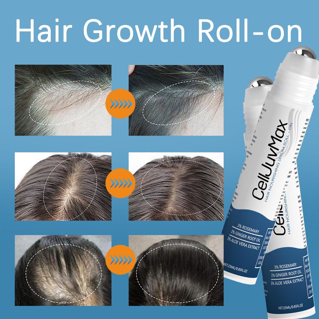 Hair Growth Serum Roll On – 0.85 Fl Oz (1 Pcs)