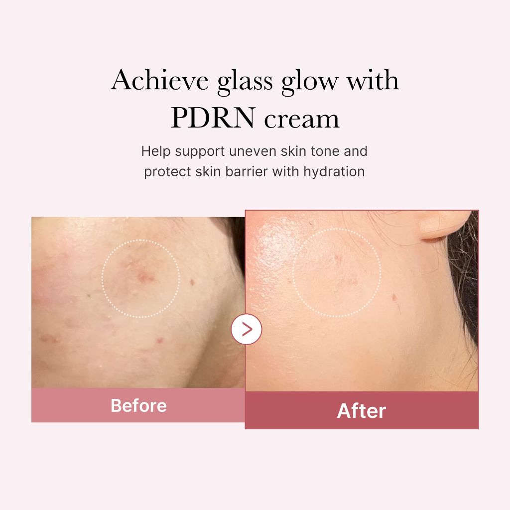 Medicube PDRN Pink Hyaluronic Moisturizing Cream, Korean Skincare - 50mL