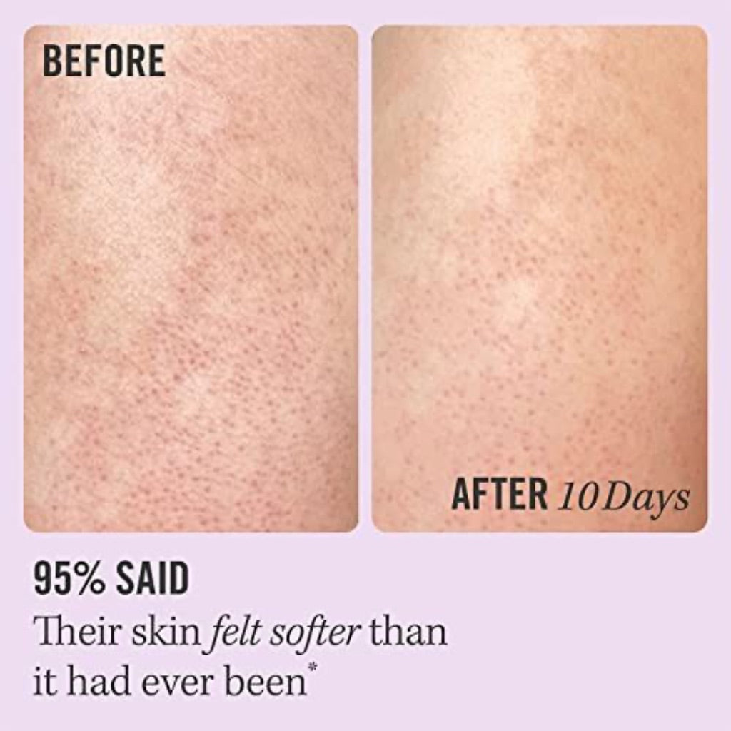 First Aid Beauty KP Bump Eraser Body Scrub with 10% AHA 283.5g
