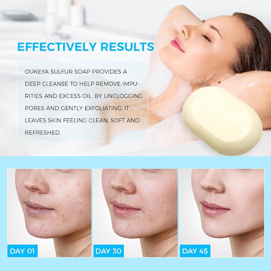 OUKEYA Sulfur Soap for Face with 10% Sulfur, 2% Salicylic Acid, (2Pk)