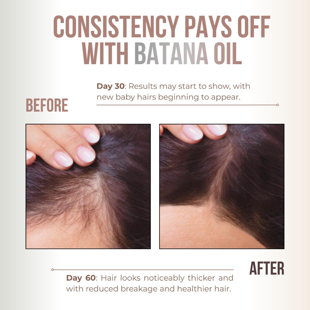 Premium Batana oil for Hair Growth |100% Raw Elaeis Oleifera for Natural Scalp Care | 4fl oz