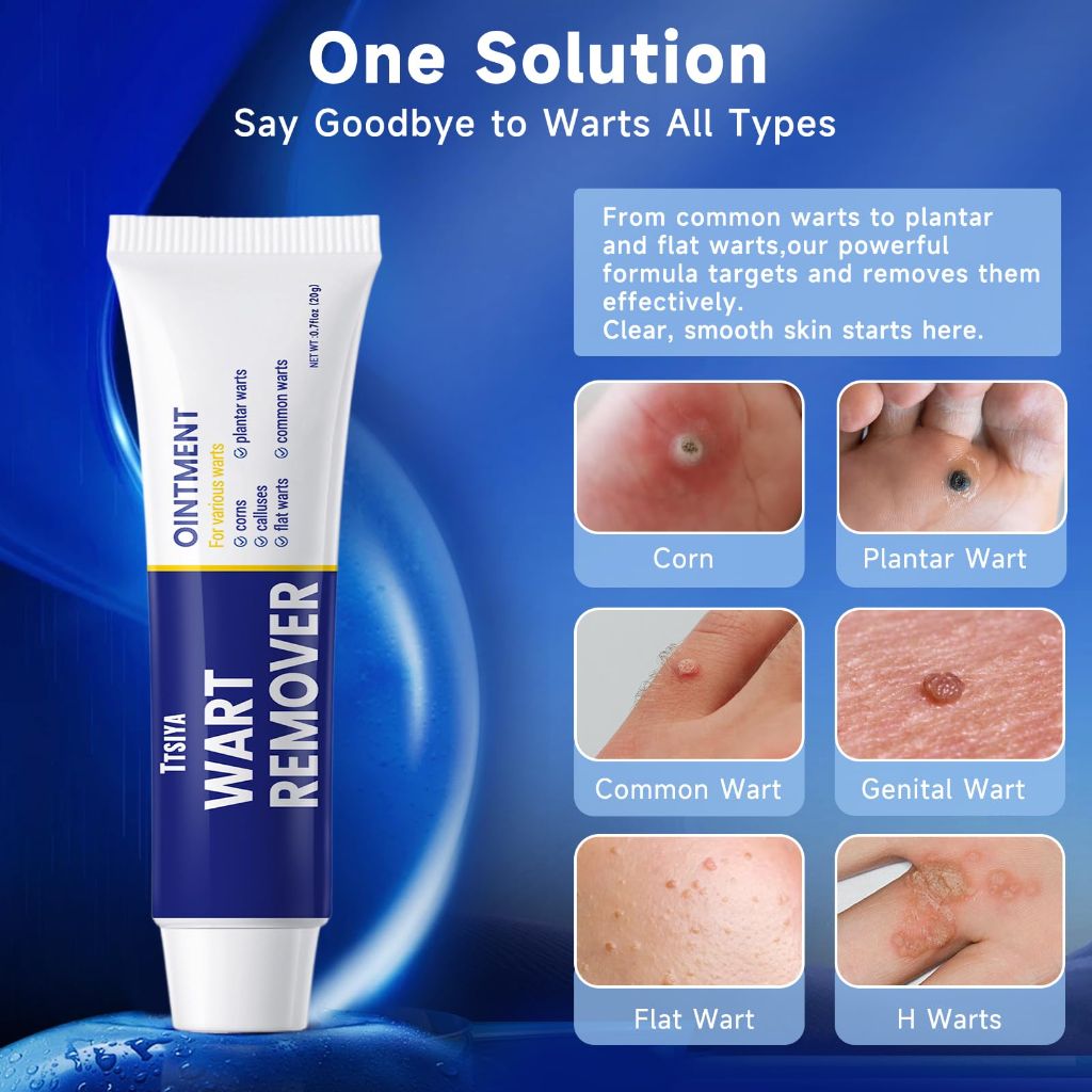 TTsiya Fast Acting Wart Remover, with Salicylic Acid for Women and Men, 20g