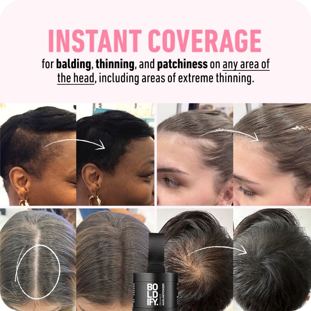 Boldify Hairline Powder + Hair Fiber Bundle for Thinning Hair, Root Cover Up (Black)