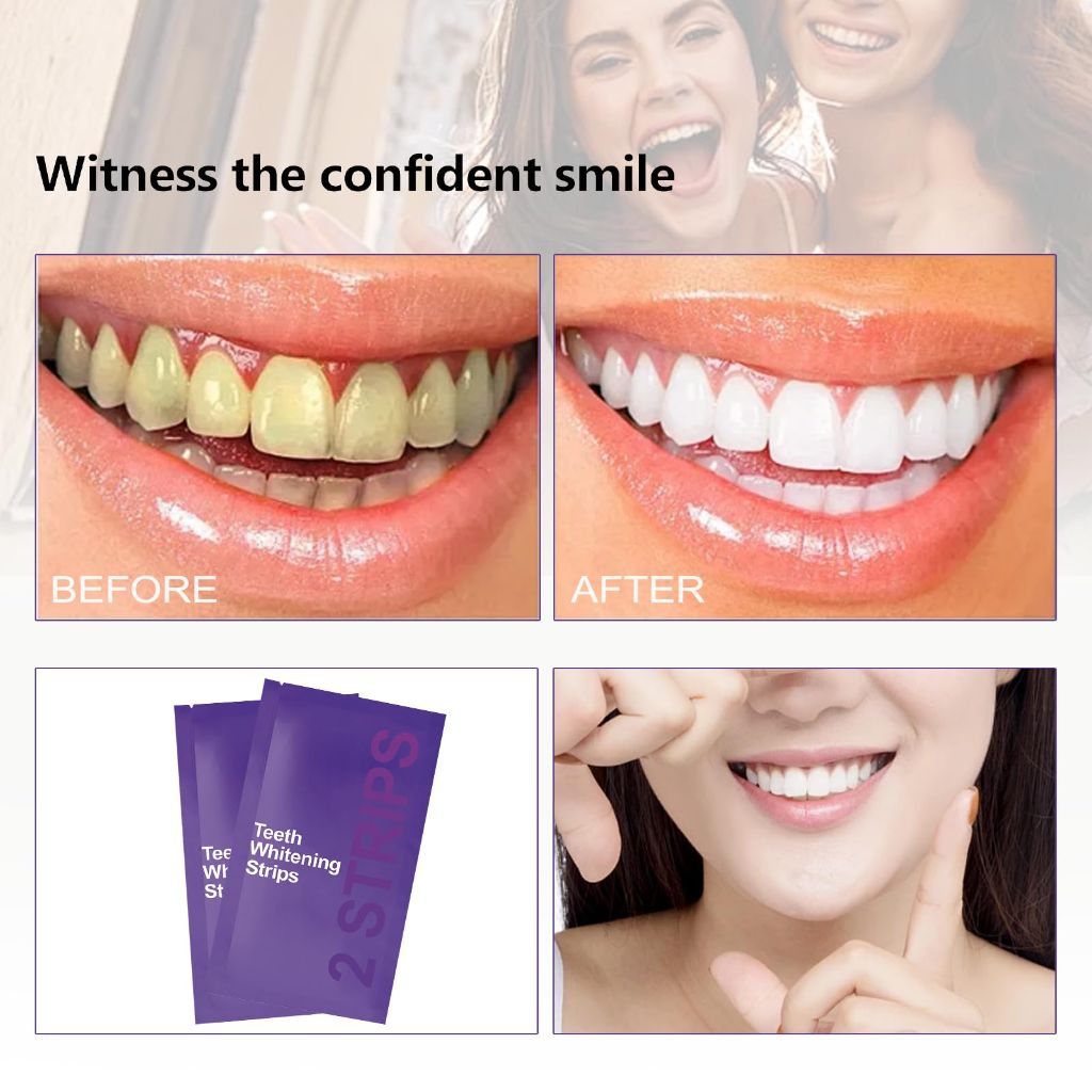 Gentle Daily Purple Teeth Whitening Strips – (14 Strips)